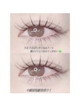 イルミン(irumin)/お悩みの方は参考に