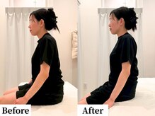 ソレア(Solea)/肩こり・首こり改善1回目