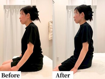 ソレア(Solea)/肩こり・首こり改善1回目