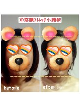 ビューティサロン キヨの部屋(beauty salon)/【３D筋膜ストレッチ小顔術】7回