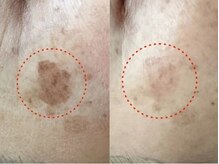 ミナミ/【長年のお悩みの方】