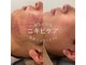 美肌ラボ クリア(clear)の写真