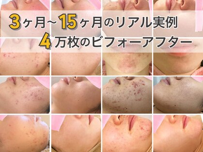 ロエヴェ(ROEWE)の写真