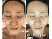 アルページュ(Arpege)