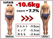 セル脂肪をドバっと撃退！太ももに隙間を作ります◎骨盤矯正+最新スリム超音波でほっそり美脚＆美尻実現！