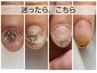 【女性/無料カウンセリングのみ】お悩みご相談(施術は含まれません)