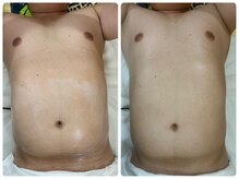 ゴールドプラス 半田店(GOLD PLUS)/BeforeAfter