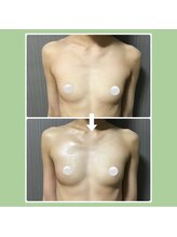 Ms.やまとなでしこ/バストアップ☆ビフォーアフター