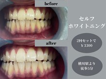 飛常識の雰囲気（セルフホワイトニングもオススメ♪）