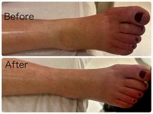 チル アンド リラックス(Chill and Relax)/むくみ解消！