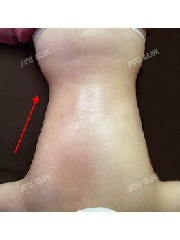 アユスリム(AYU SLIM)/一回でも変化できるの充実痩身!