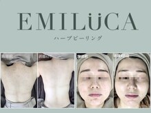 エミルカ(EMILUCA)