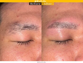 眉ダンディズム 大阪天神橋六丁目店/お顔の印象は8割眉毛で決まる！