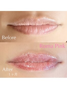 リラ(Lyra)/ローマピンク