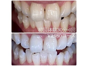 ホワイトニングルーム 横浜店(Whitening Room)/セルフホワイトニング/横浜
