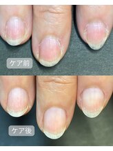 キラリネイル(KIRARINAIL)/お客さまの変化