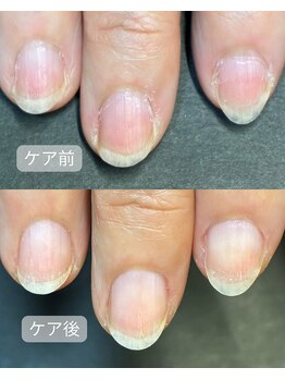 キラリネイル(KIRARINAIL)/お客さまの変化