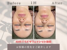 トータルビューティー雅/どんなお肌のお悩みも任せて！