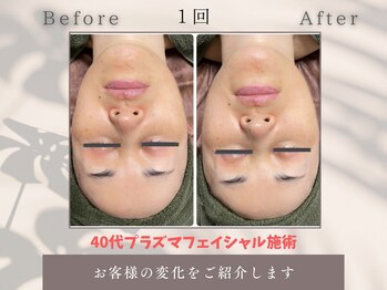 トータルビューティー雅/どんなお肌のお悩みも任せて!