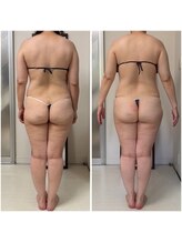セルビューティー(Cell Beauty)/アラフィフ、食事制限なし！