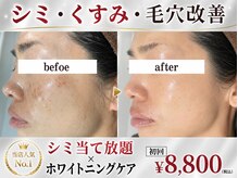 パールホワイトニングサロン 大船店