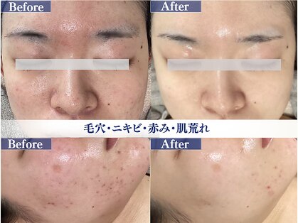 レクラ バイ ドクターエイチ(L'ECLAT by Doctor.H)の写真