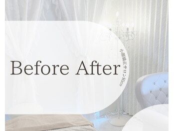 リコ(Rico)/【お客様ビフォーアフター】