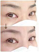 エム/まつ毛パーマ/エグータム