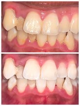 ライトビューティー 池袋店(LightBeauty)/症例写真