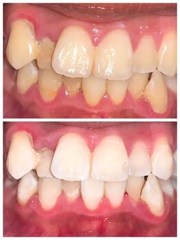 ライトビューティー 池袋店(LightBeauty)/症例写真