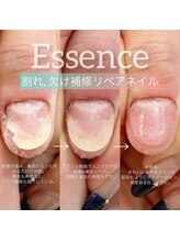 エッセンス (Essence)/自爪保護＋補強におすすめ◎