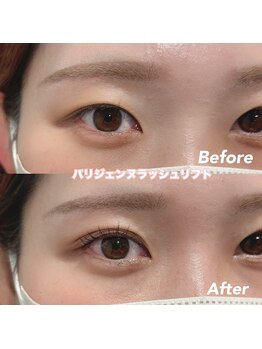 レディエント(Radiant)/パリジェンヌラッシュリフト