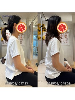 グレフル鍼灸接骨院 整体院 心斎橋/整体/肩こり/マッサージ/腰痛