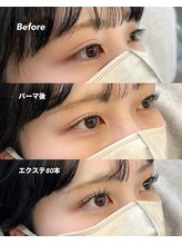 イム(im)/パリエク100本