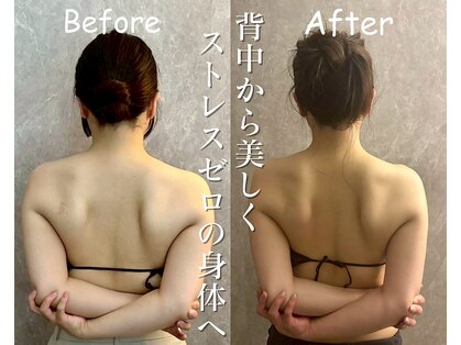 マイティー整骨院 ココア(CoCoa)の写真