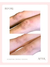 ビジュアルラボ(VISUAL LABO)/