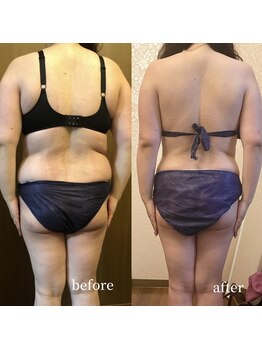 スワロ(suwaro)/30代 2ヵ月本気ダイエット