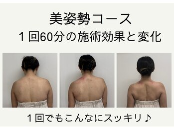 ジェム鍼灸サロン 横浜元町(gem鍼灸サロン)/美姿整コース６０分の変化☆