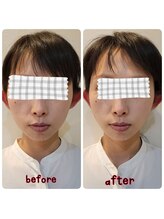 ピエール ナリタイラボ(Piel NARITAI LABO)/小顔整体