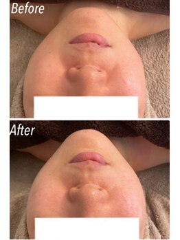 ビジュープラス つくば店(Bijou+)/小顔矯正陶肌トリートメント