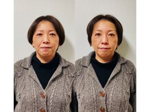 フェイスドット 梅田院(Face.)の雰囲気（Face.オリジナルのセプタプル美容鍼灸でお悩みを解決します☆）