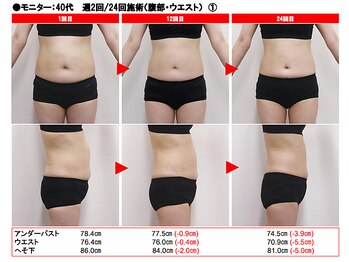 おうちサロン しゅろ/ダイエットやコリほぐしのマシン