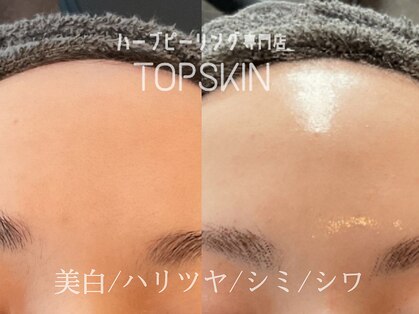トップスキン 表参道(TOPSKIN)の写真