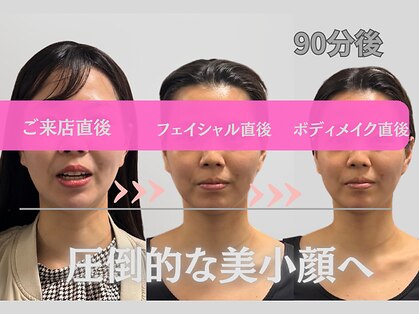 エンジェル(Angel)の写真