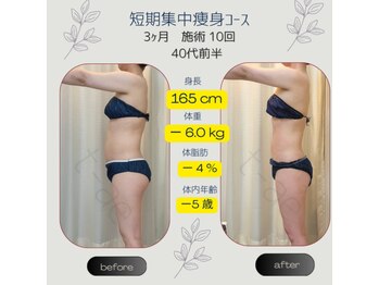 ティアエ(T-ae)/本気ヤセ【短期集中痩身コース】