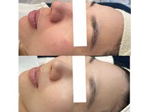 パリスヒロトン(PARIS HIROTON)の雰囲気（機械多数完備！貴方に合う組み合わせで早☆痩身！）