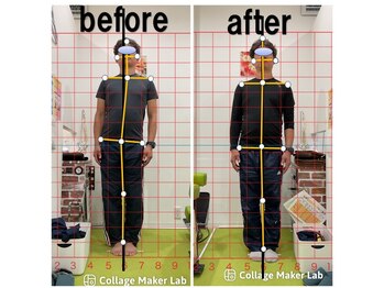 上本町骨盤整体院グッド/「整体による姿勢の変化」