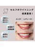 【導入キャンペーン】速効性抜群セルフホワイトニング32分照射¥4950→¥3000