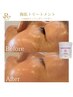 【お肌悩み】漢方蒸し＋毛穴洗浄＋ピーリングセット　￥15000