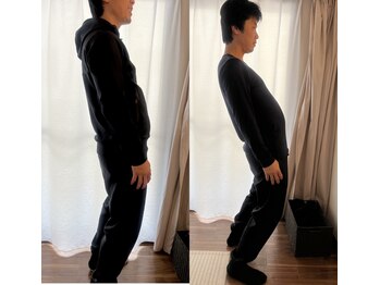 けんたろう鍼灸院/腰痛